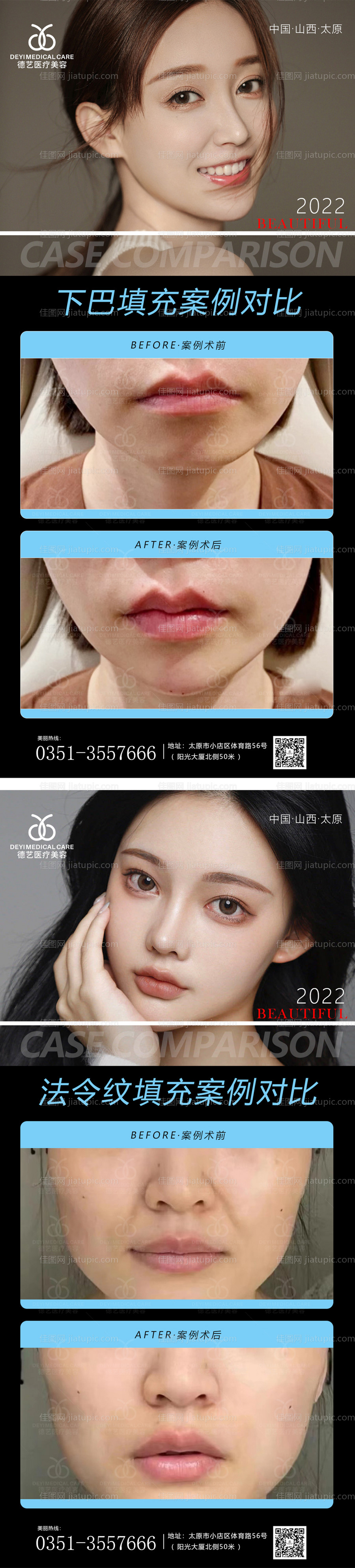 医美案例对比图-源文件